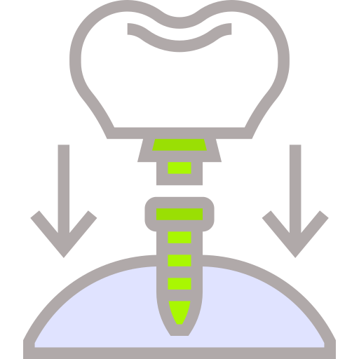 dental-implant